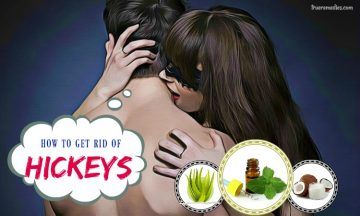 tricks on how to get rid of hickeys