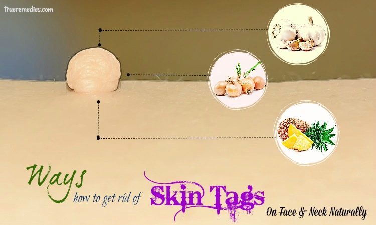 how to get rid of skin tags on face