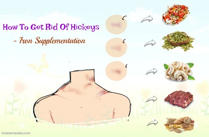 how to get rid of hickeys - iron supplementation