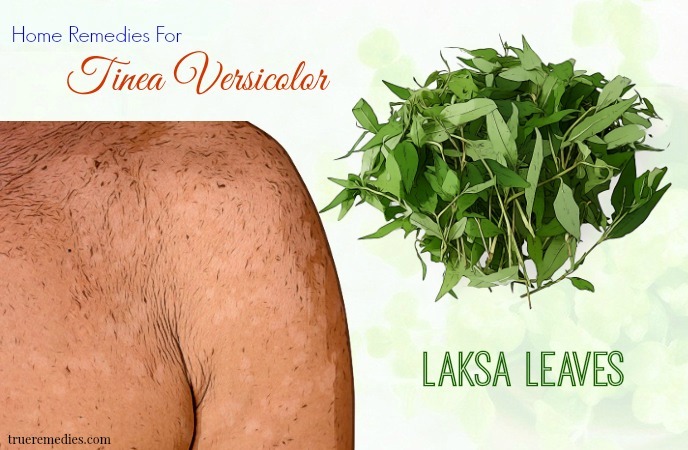 home remedies for tinea versicolor - laksa leaves