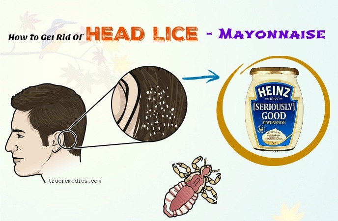 how to get rid of head lice - mayonnaise