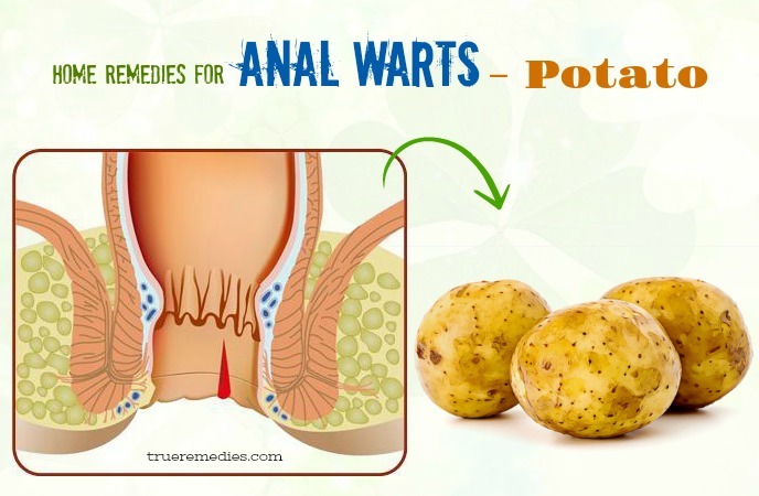 home remedies for anal warts - potato