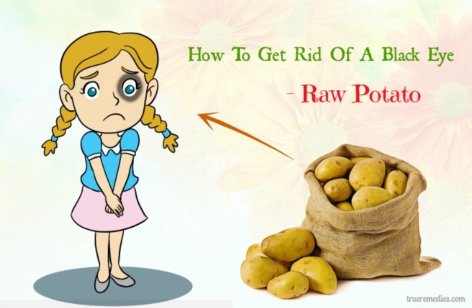 how to get rid of a black eye - raw potato