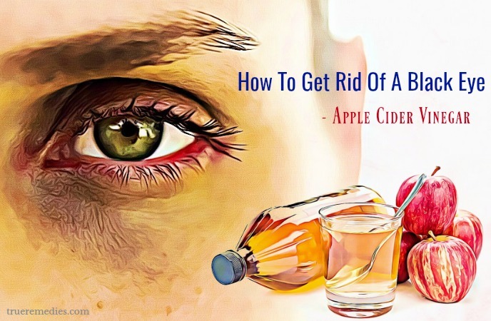 how to get rid of a black eye - apple cider vinegar