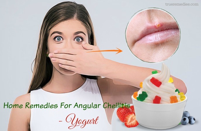 home remedies for angular cheilitis - yogurt