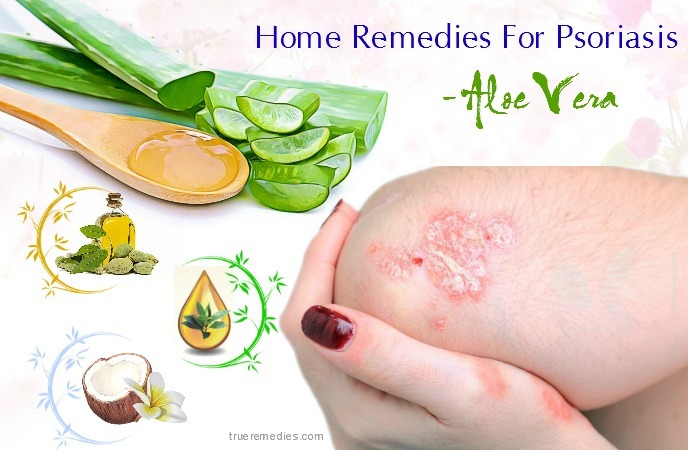 home remedies for psoriasis on face - aloe vera