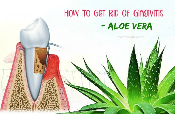 how to get rid of gingivitis - aloe vera