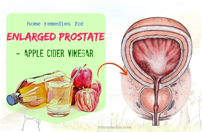 natural home remedies for enlarged prostate - apple cider vinegar