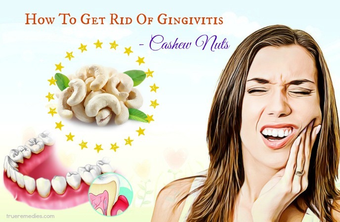 how to get rid of gingivitis - cashew nuts