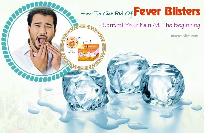 how to get rid of fever blisters - control your pain at the beginning