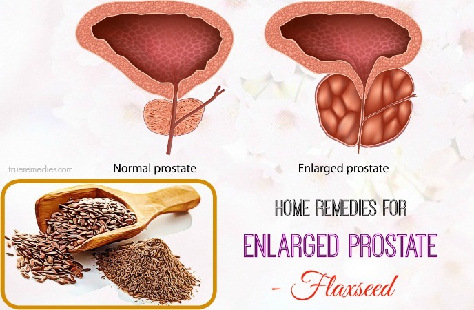 natural home remedies for enlarged prostate - flaxseed