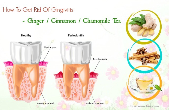 how to get rid of gingivitis - ginger cinnamon chamomile tea