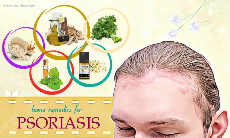 home remedies for psoriasis on face