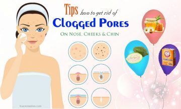how to get rid of clogged pores on chin