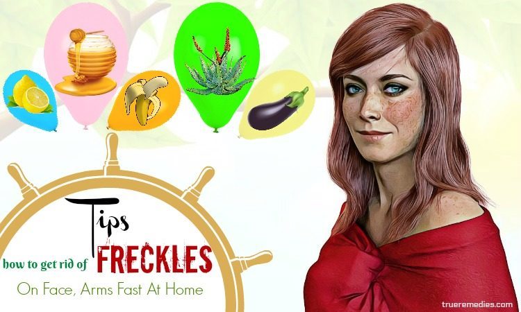 how to get rid of freckles on face