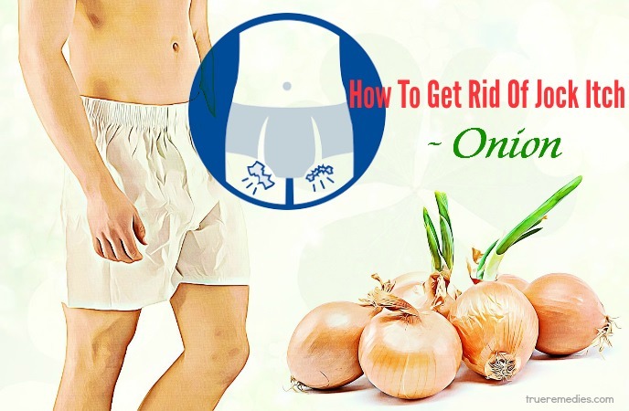 how to get rid of jock itch - onion