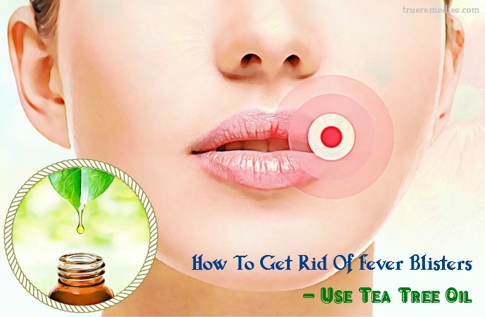 how to get rid of fever blisters - use tea tree oil