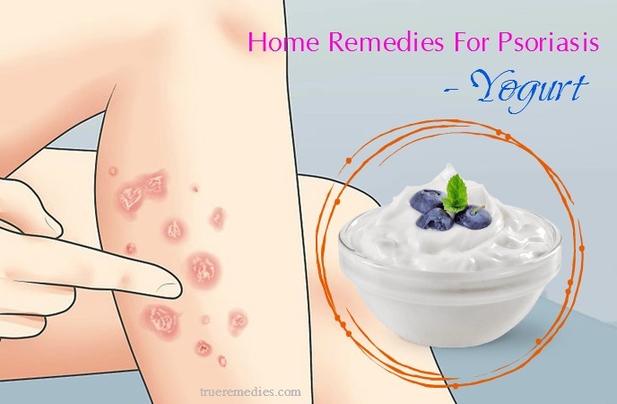 home remedies for psoriasis on hands - yogurt