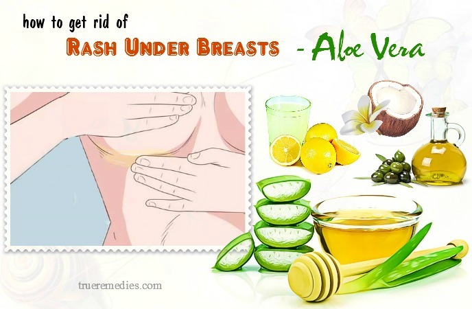 tips on how to get rid of rash under breasts - aloe vera