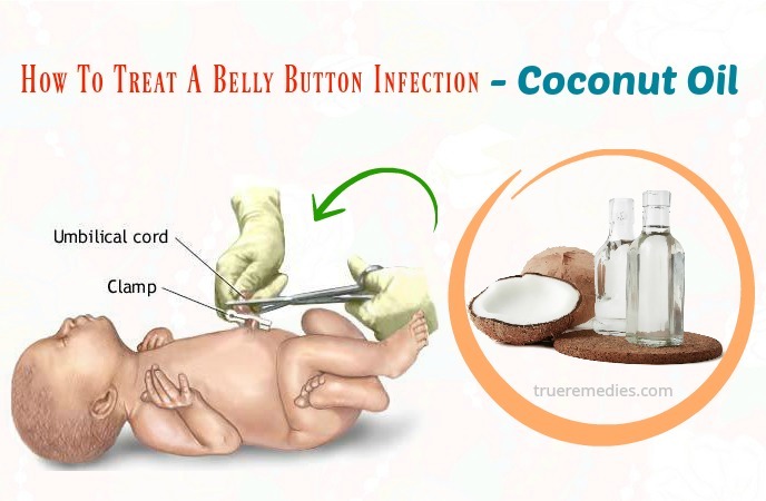 how to treat a belly button infection - coconut oil