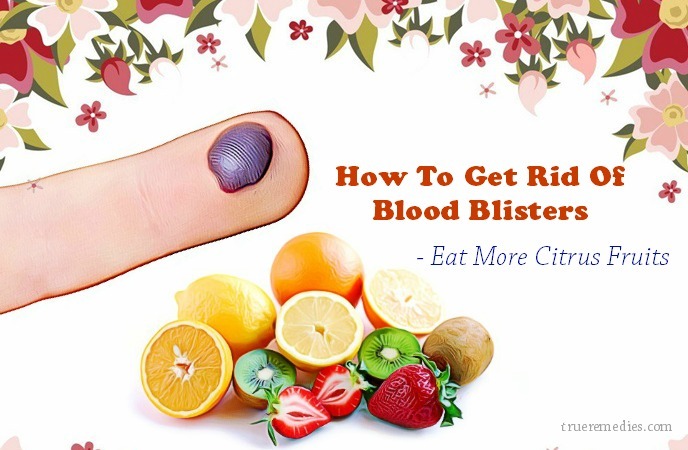 how to get rid of blood blisters - eat more citrus fruits