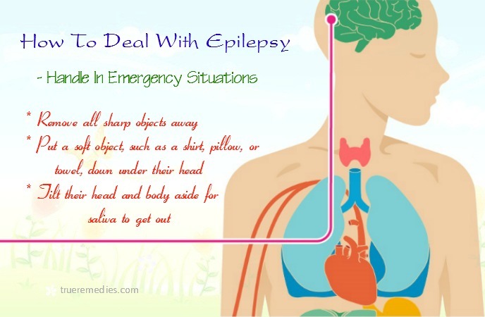 how to deal with epilepsy seizures - handle in emergency situations