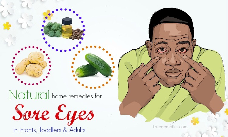 home remedies for sore eyes in adults
