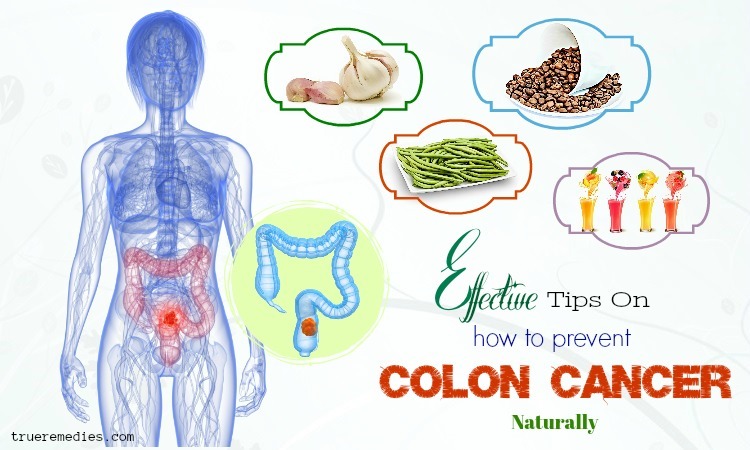 tips on how to prevent colon cancer