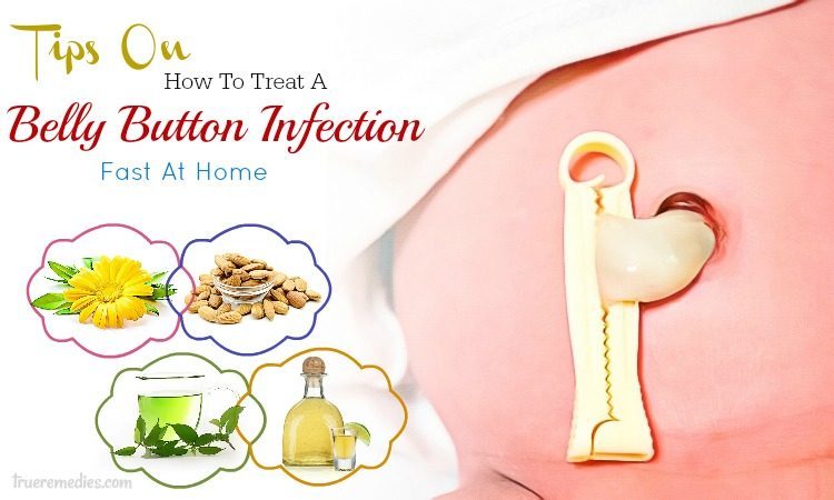 tips on how to treat a belly button infection