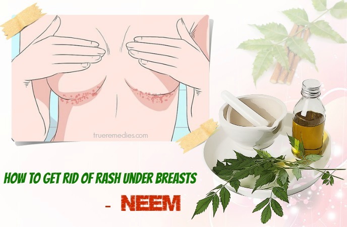 how to get rid of rash under breasts fast - neem