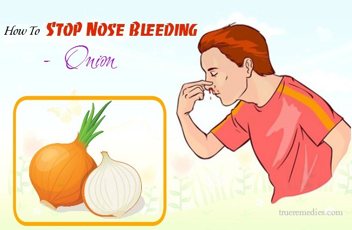 how to stop nose bleeding at home - onion