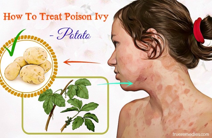 how to treat poison ivy rash - potato