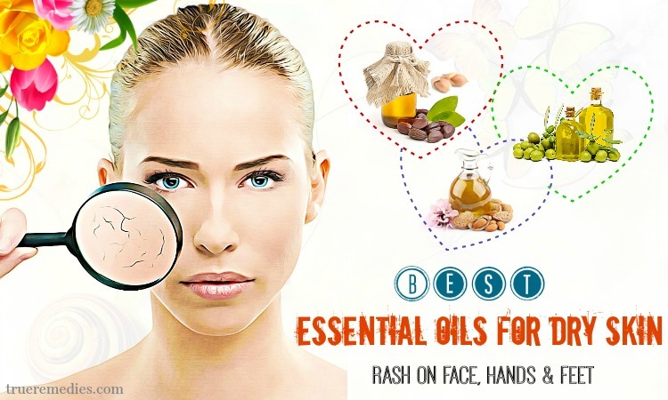 essential oils for dry skin on hands
