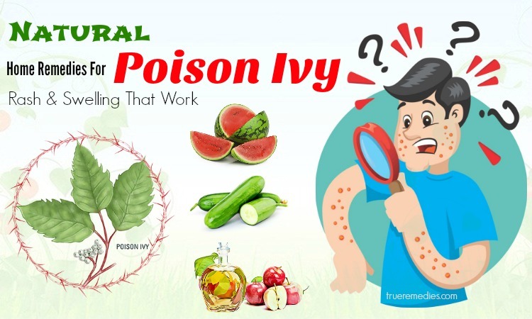 home remedies for poison ivy swelling