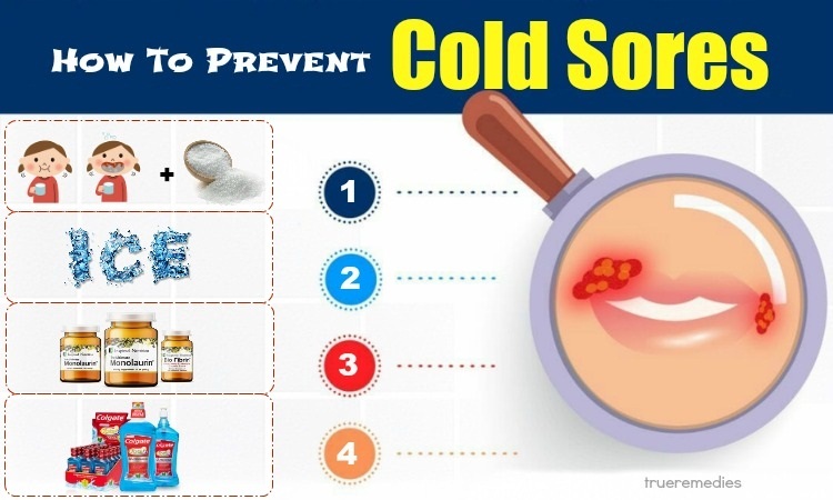 how to prevent cold sores inside mouth