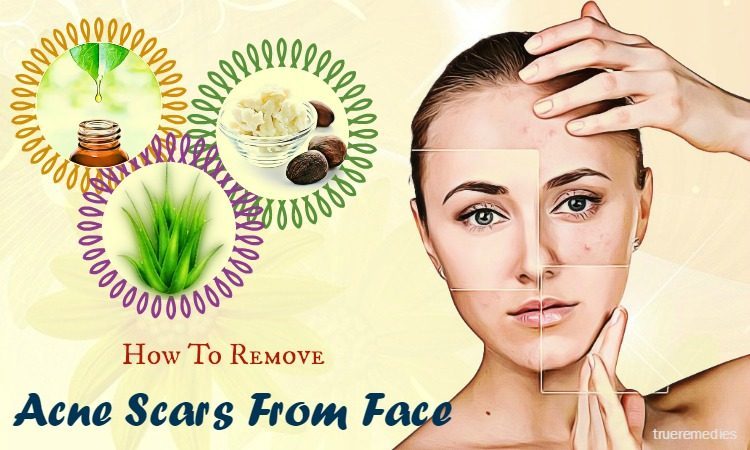 how to remove acne scars from face quickly