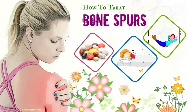 tips on how to treat bone spurs