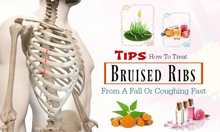 tips on how to treat bruised ribs