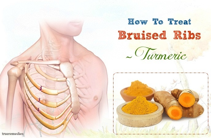 displaced ribs treatment