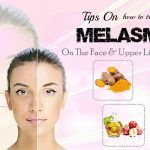 how to treat melasma on upper lip