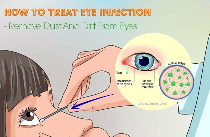 remove dust and dirt from eyes