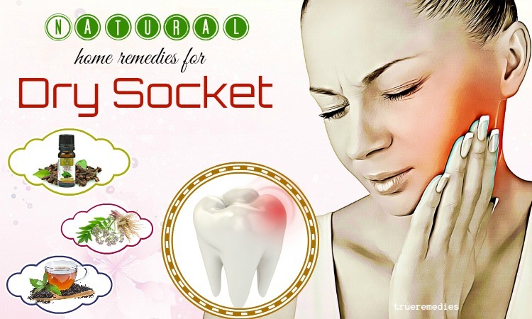 home remedies for dry socket in mouth