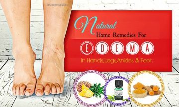 home remedies for edema in feet