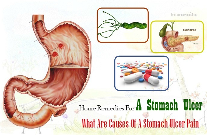 home remedies for a stomach ulcer - what are causes of a stomach ulcer pain