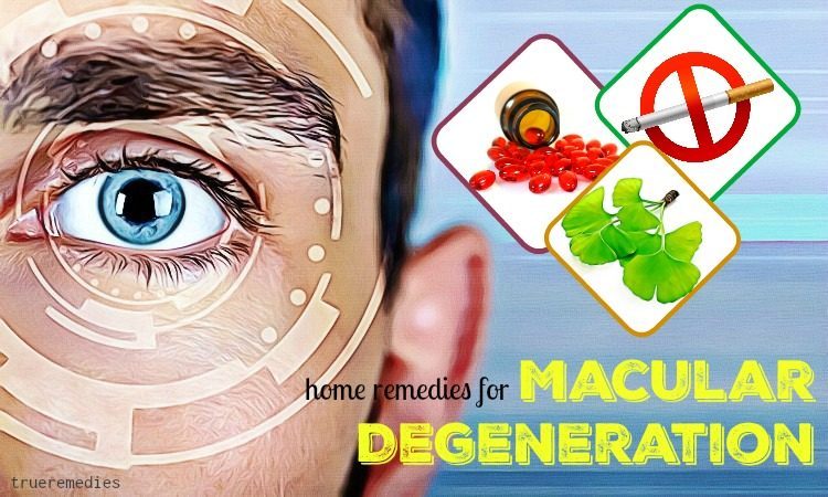 natural home remedies for macular degeneration