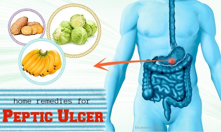 home remedies for peptic ulcer pain