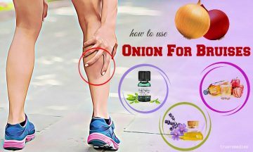 how to use onion for bruises removal