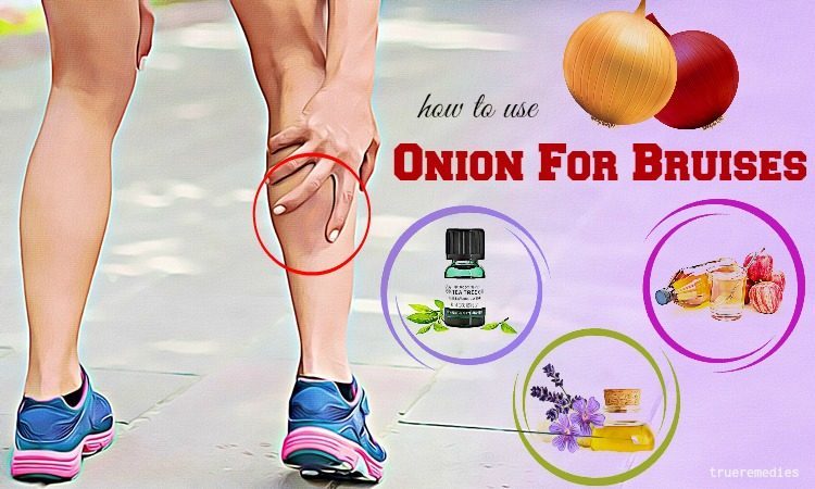 how to use onion for bruises removal