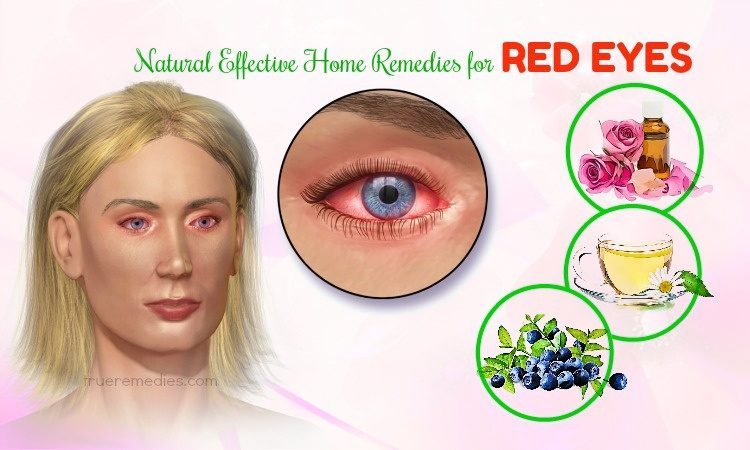 home remedies for red eyes