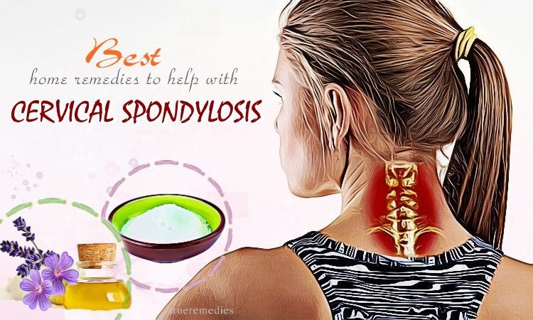 home remedies to help with cervical spondylosis